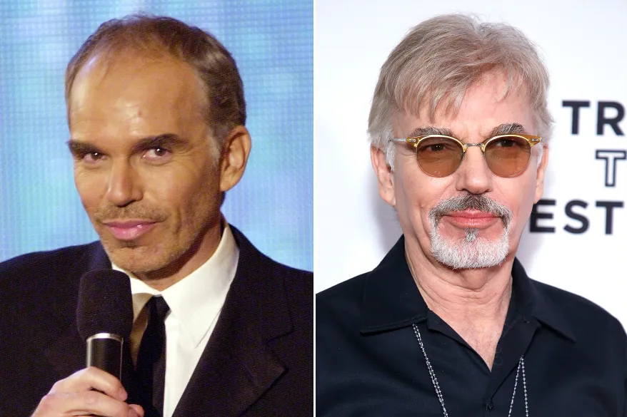 billy bob thornton hair transplant