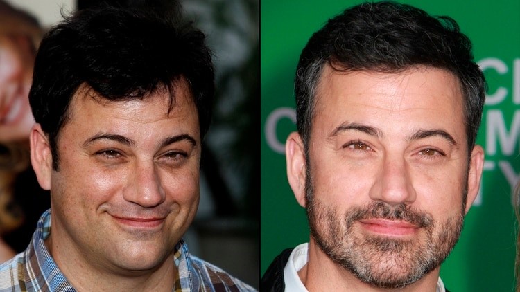 Jimmy Kimmel Hair Transplant: Before & After Hairline Analysis