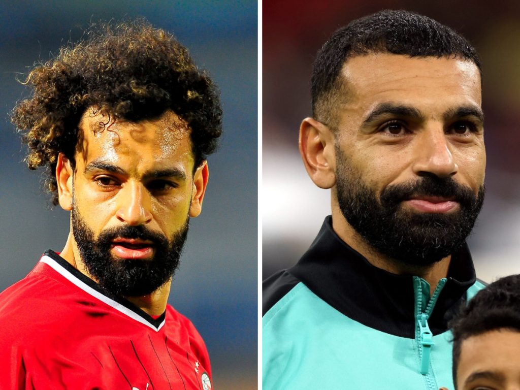 Mo Salah Hair Transplant Before After Technique Hairline Analysis 