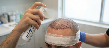 panthenol-spray-after-hair-transplant