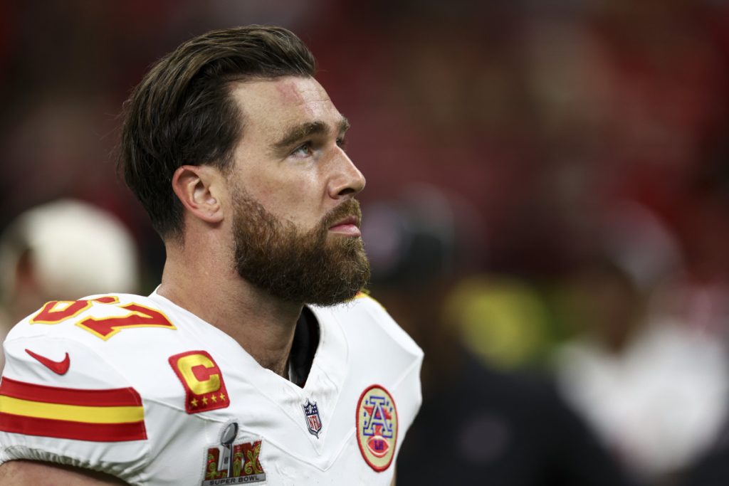 Travis Kelce Hair Transplant: Before After, Hairline Analysis & Cost 2 Travis Kelce Hair Transplant: Before After, Hairline Analysis & Cost