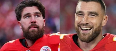 travis-kelce-hair-transplant-review