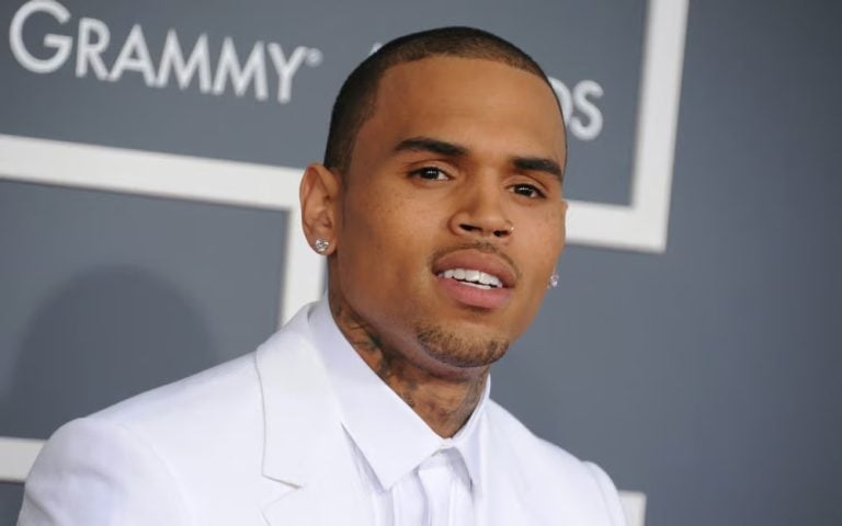 Where Did Chris Brown Get His Hair Transplant? Hairline Analysis