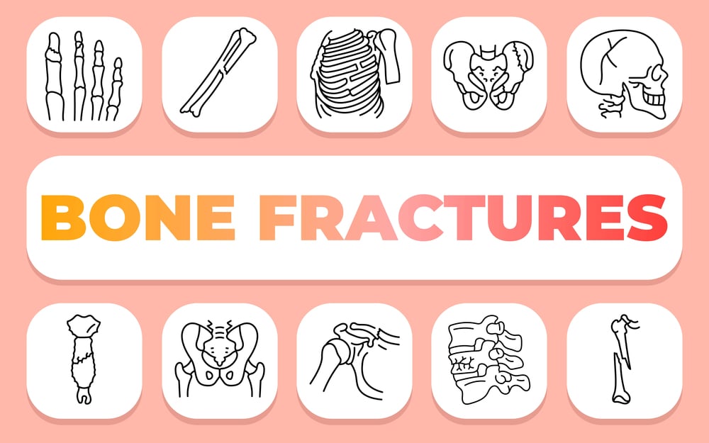 How Long Does a Hairline Fracture Take to Heal? Timeline & Recovery