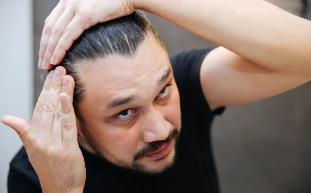 Does Creatine Cause Hair Loss? Latest Research & Expert Answers 1 does creatine cause hair loss