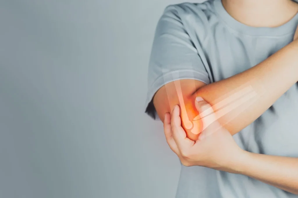 How Long Does a Hairline Fracture Take to Heal? Timeline & Recovery