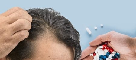 finasteride-for-hair-loss-treatment