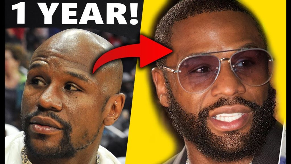 Floyd Mayweather Hair Transplant: Before & After + Beard Analysis