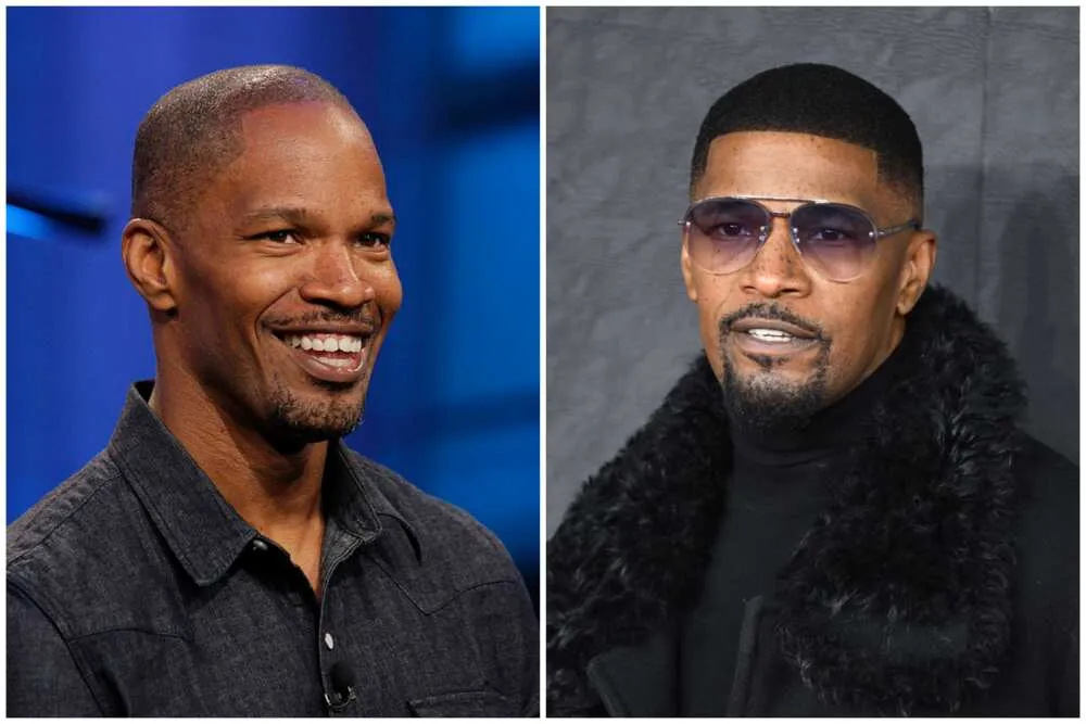 Jamie Foxx Hair Transplant: Before & After Hairline Analysis 2 Jamie Foxx Hair Transplant: Before & After Hairline Analysis