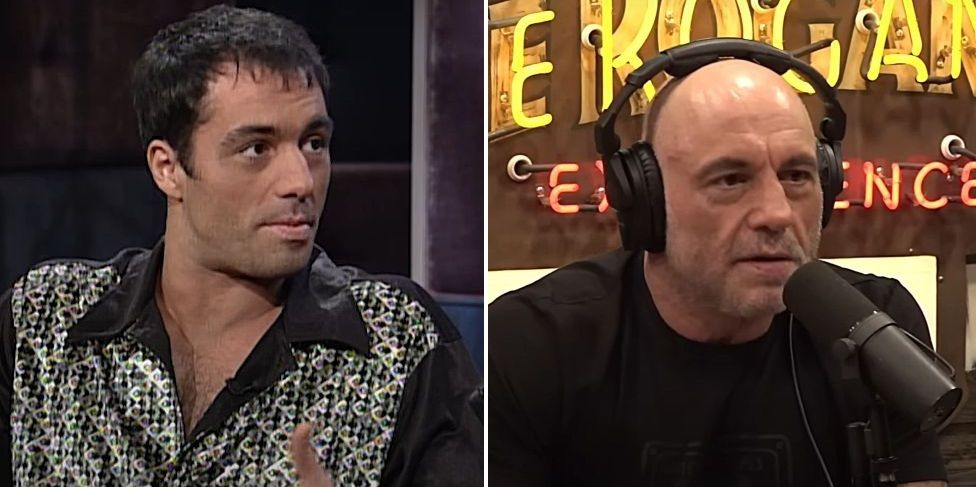 Joe Rogan Hair Transplant: FUT Scar, Story & Hair Loss Explained