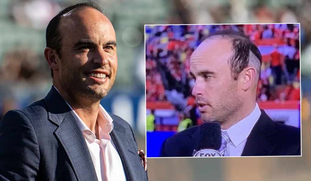 Landon Donovan Hair Transplant: Before & After Hairline Analysis 2 Landon Donovan Hair Transplant: Before & After Hairline Analysis