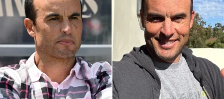 landon-donovan-hair-transplant