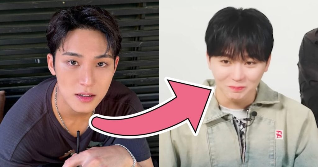 mingyu hair transplant