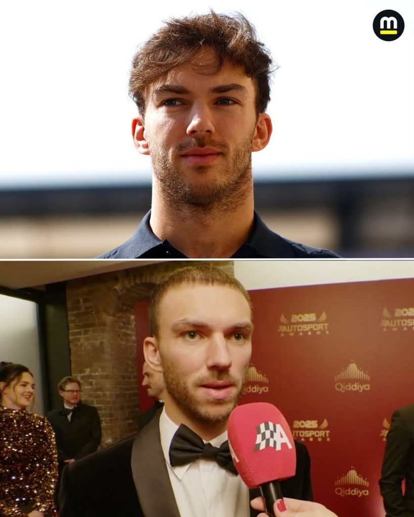 Pierre Gasly Hair Transplant: Before & After Hairline Analysis 3 pierre gasly hair transplant