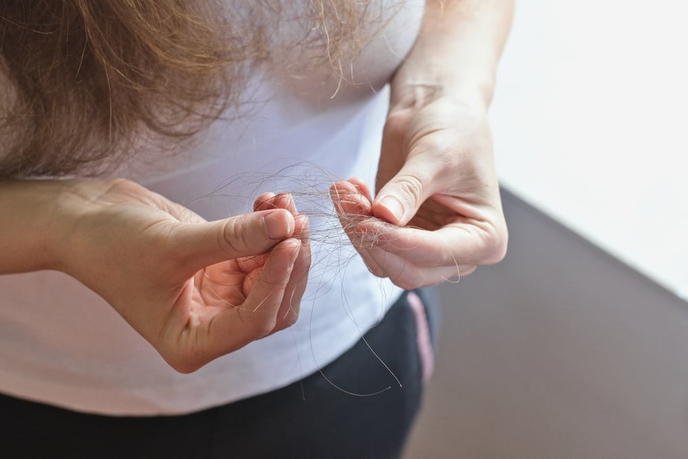 postpartum hair loss