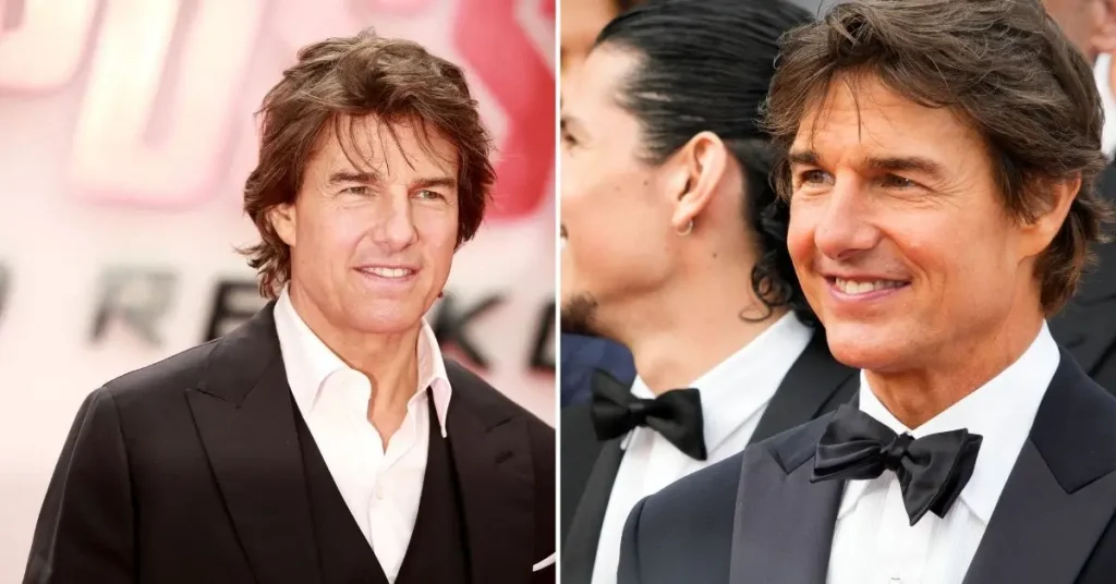 Tom Cruise Hair Transplant: Hairline Analysis & Before After 2 Tom Cruise Hair Transplant: Hairline Analysis & Before After