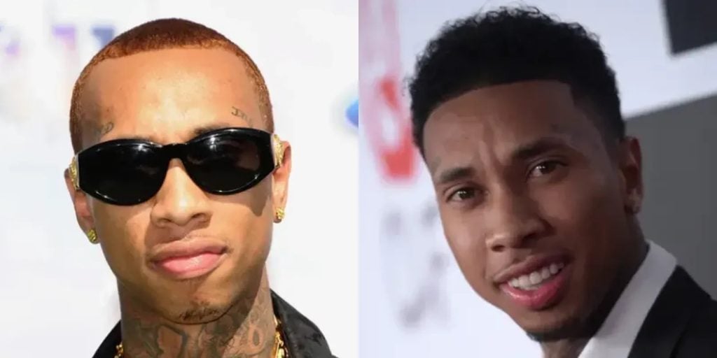 Tyga Hair Transplant: Before & After, Cost, Grafts & Results