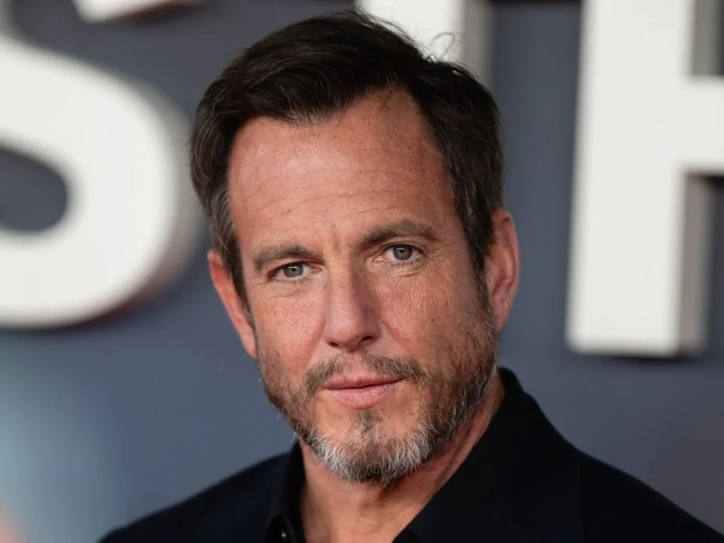 Will Arnett Hair Transplant: Did He Really Fix His Hairline? 3 Will Arnett Hair Transplant: Did He Really Fix His Hairline?