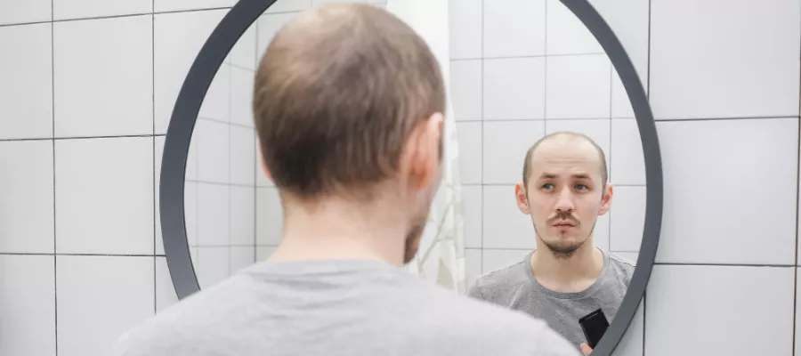 Ein realistischer Leitfaden für alle, die vor einer Haartransplantation zögern