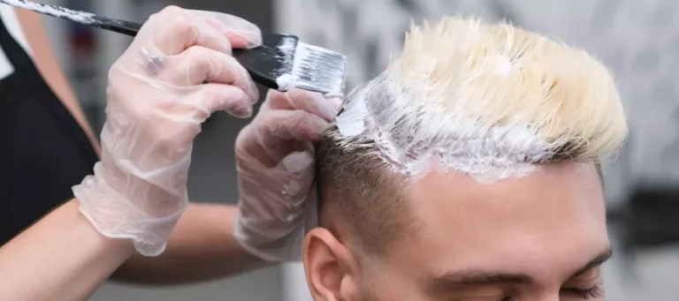 Can hair be dyed after a hair transplant?