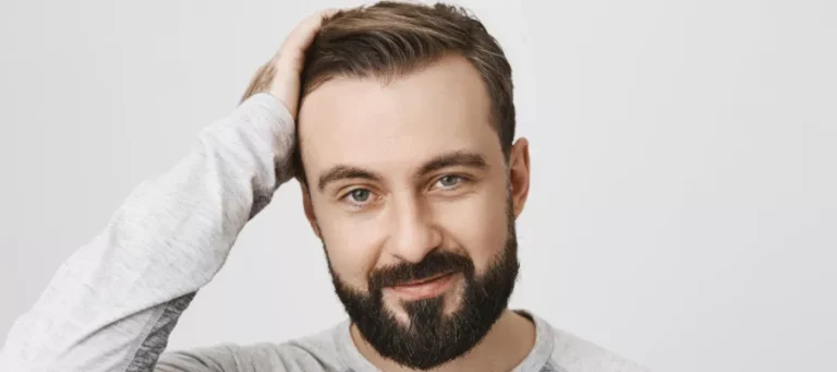 Does facial shape change after a hair transplant?