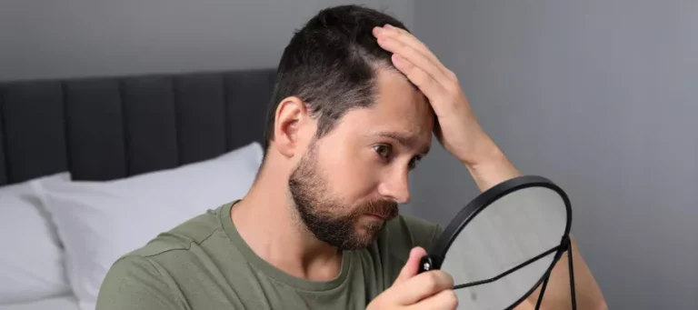 How to Manage Expectations for Hair Density After Hair Transplantation?