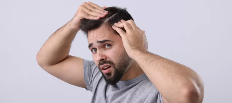 What happens if a hair transplant fails?