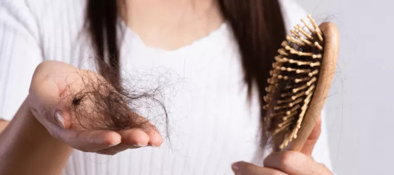 When Should You See A Specialist For Hair Loss?