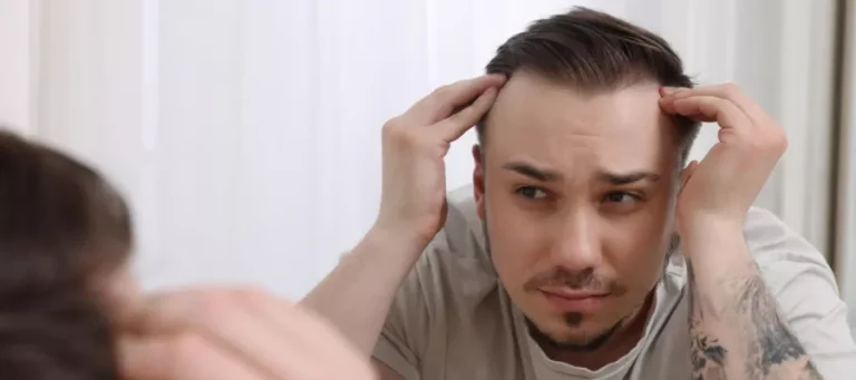 Why does hair transplantation result in an unnatural appearance?