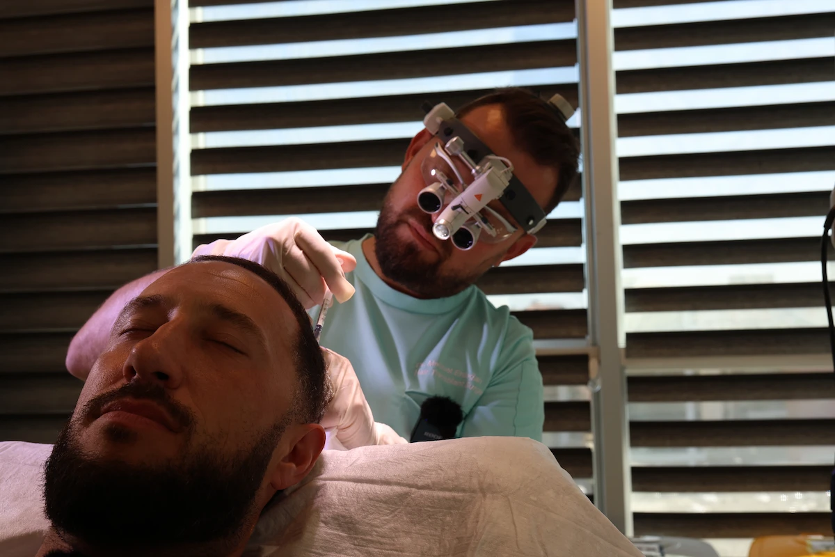 Mike Majlak Back to Smile Hair Clinic, This Time for PRP and Exosome Therapy 2 Dr. Mehmet Erdoğan Mike Majlak performs PRP and Exosome treatments.