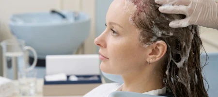 How to Wash Your Hair After a Female Hair Transplant